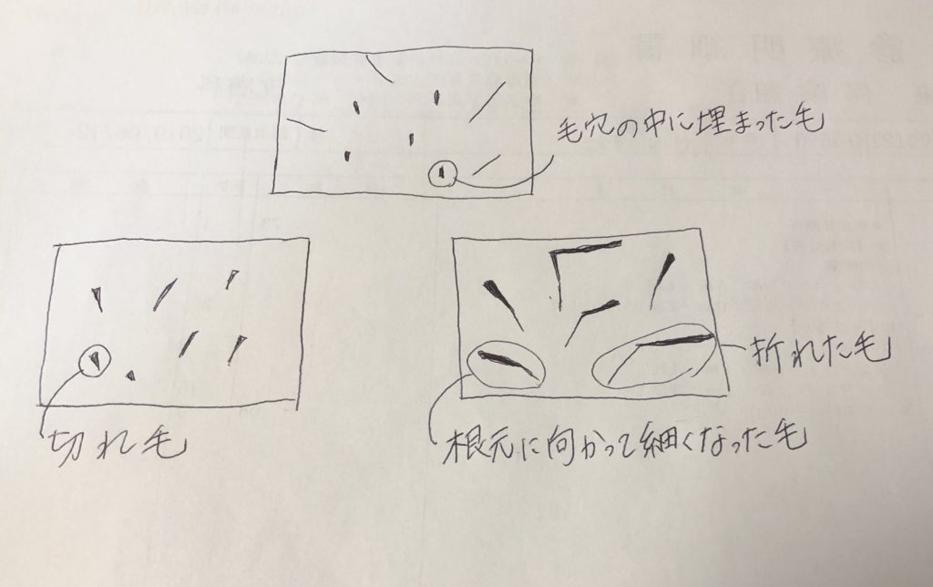 円形脱毛症が進行しているときの髪の毛の状態